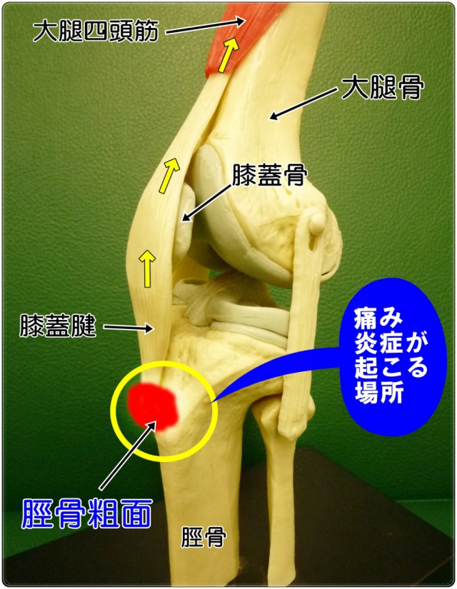 痛み炎症がおこる場所