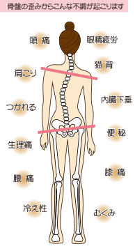 骨盤の歪みからこんな不調が起こります