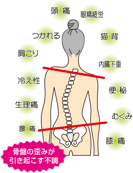 骨盤の歪みが引き起こす不調