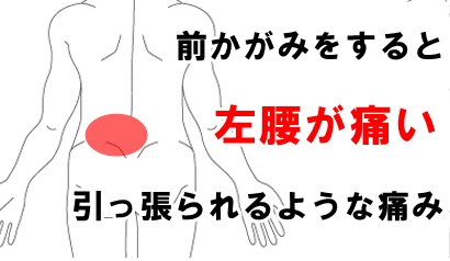 50代 男性 前かがみをすると左腰が痛む 症例 しゅはら鍼灸整骨院 京都府亀岡市千代川町